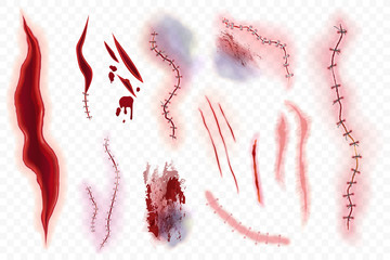 Woundcare Management